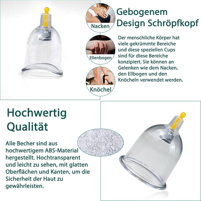 Thumbnail 4 de 24 Stück Schröpfgläser mit Vakuumpumpe