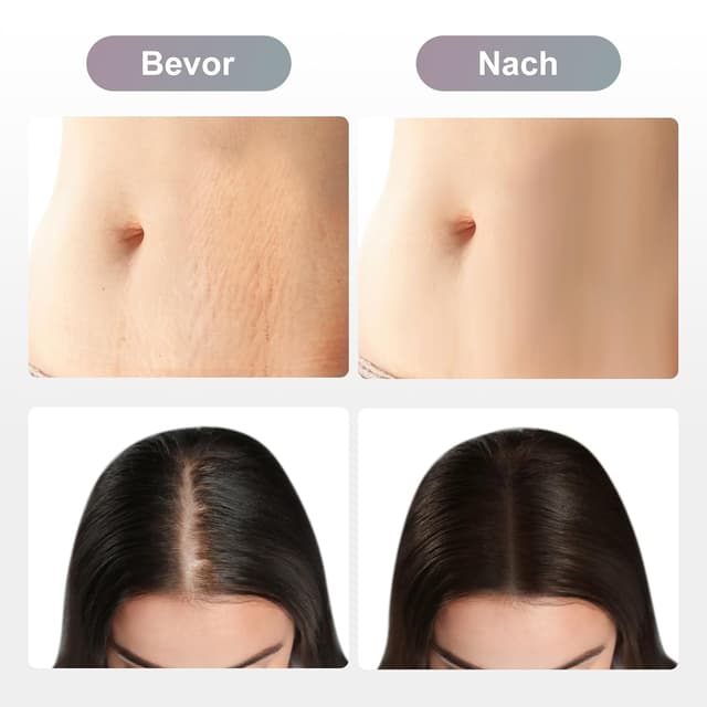 Detalle 2 de Dr. pen Ultima 36 Pins Kartuschen für M8/M7S