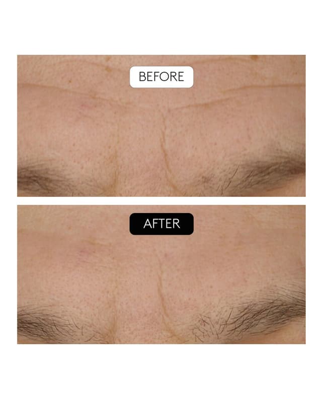 Thumbnail 3 de Cocunat Sérum Antiarrugas Clinical Beauty Filler 30 ml