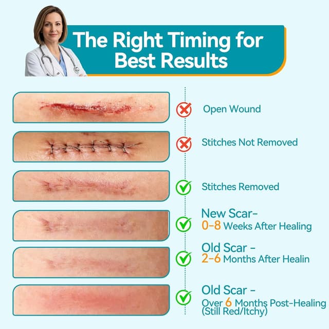 Detalle de Dimora Medical Grade Silicone Scar Sheets (4cm x 3m) for waterproof scar treatment