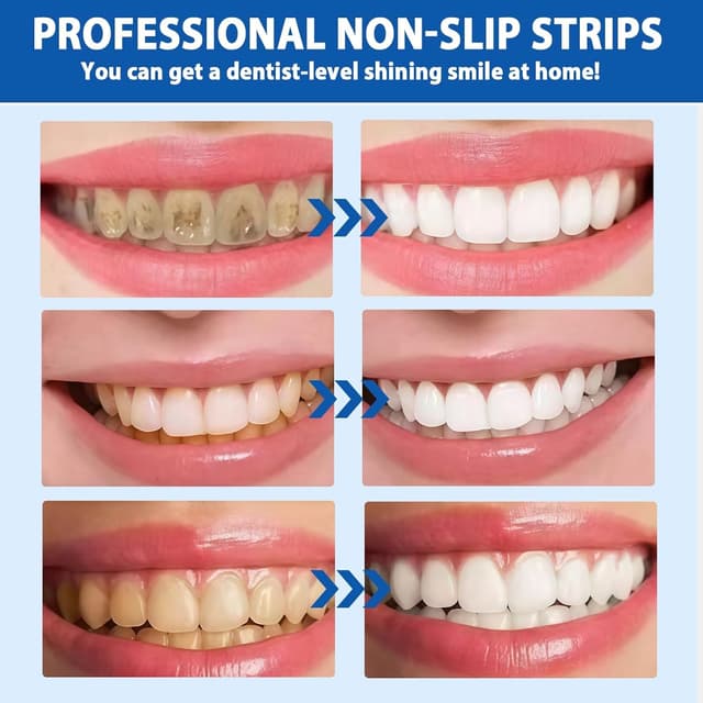 Thumbnail 5 de Lapiz Blanqueador Dental Kit con Tiras Blanqueadoras