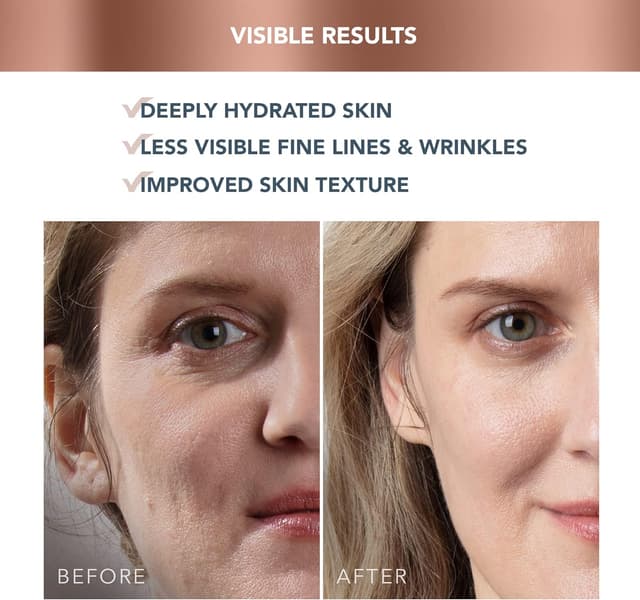 Detalle 2 de FOREO SUPERCHARGED HA+PGA Feuchtigkeitscreme 50 ml