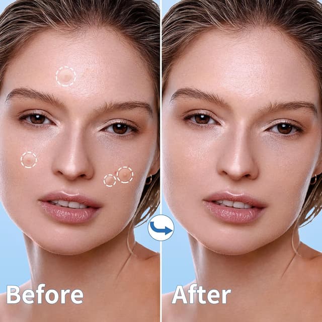 Thumbnail 4 de Daolyo Pimple Patches 300-count acne stickers