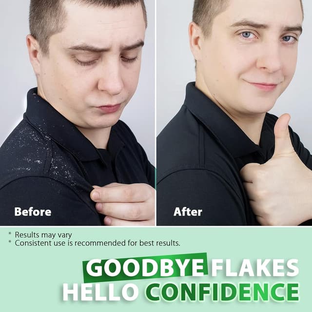 Thumbnail 4 de Anti Schuppen Shampoo mit Salicylsäure