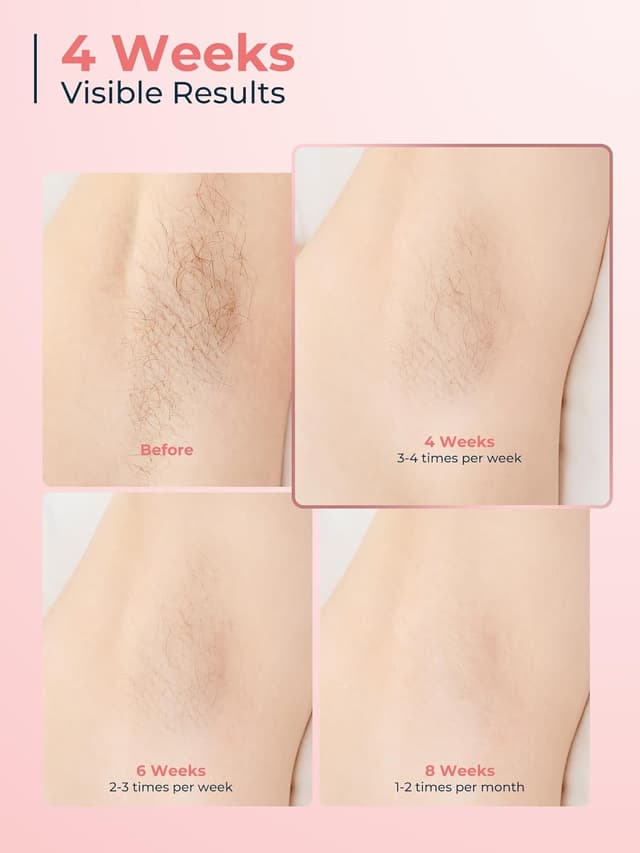 Thumbnail 3 de Beauris IPL Laser Hair Removal Device 9 levels