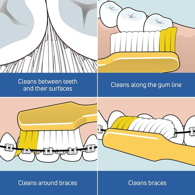 Detalle 2 de TePe Nova spazzolino a setole medie con punta sporgente (colori assortiti)