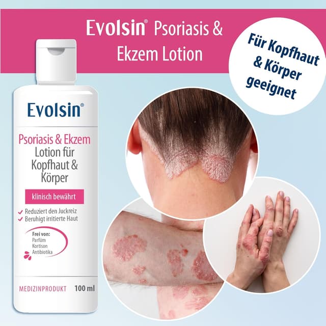 Detalle 2 de Evolsin® Ekzem & Psoriasis Lotion für Kopfhaut und Körper – gegen Juckreiz und Schuppenflechte