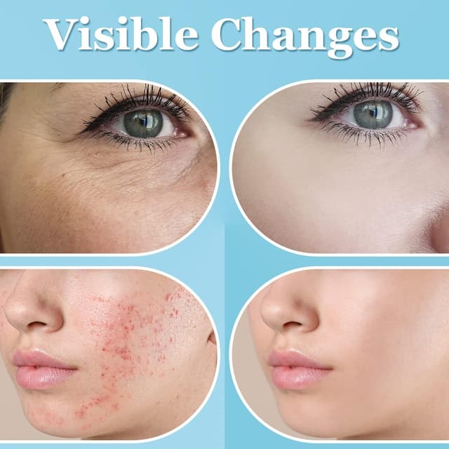 Detalle de UUPAS Bacchetta Alta Frequenza viso 6 tubi