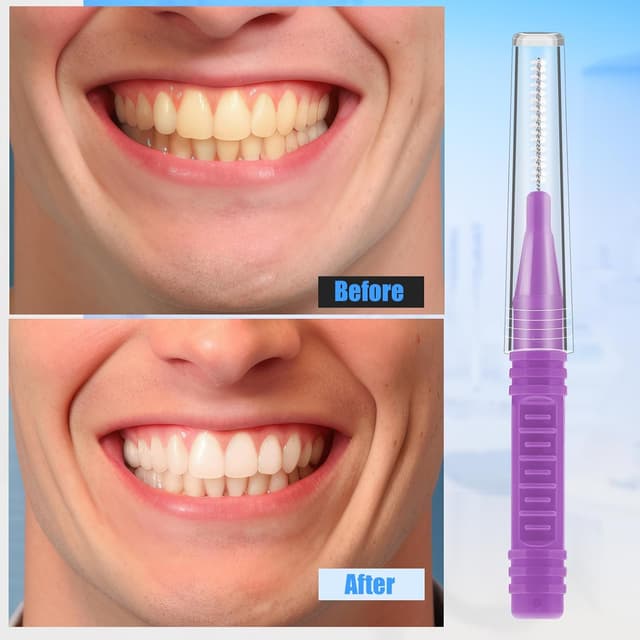 Detalle 2 de RAYITO 100 Interdental Brushes 5 sizes 🪥