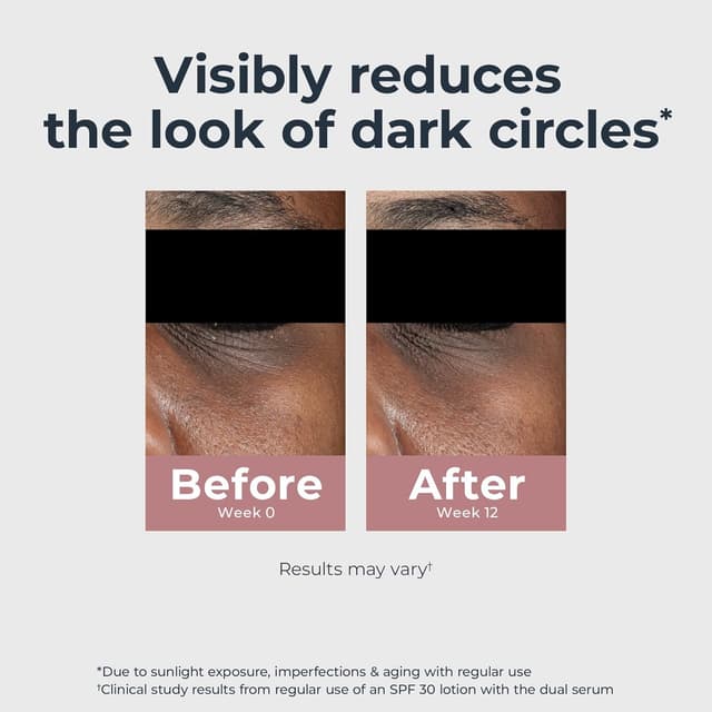 Detalle de Eucerin Radiant Tone Eye Cream for Dark Circles & Eye Puffiness (Thiamidol + Hyaluronic Acid), 0.5 oz