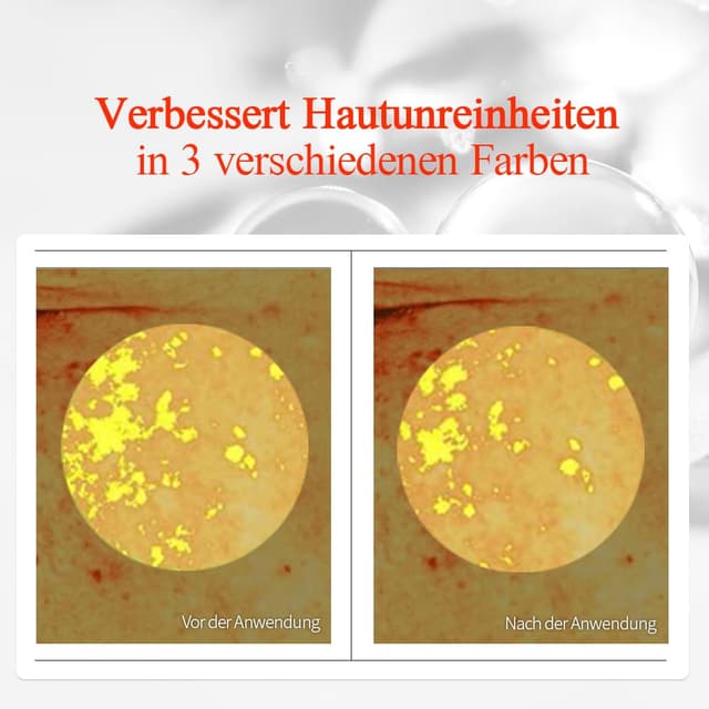 Detalle de Pyunkang Yul Brightening Vita Toner mit Vitamin C & Niacinamid – Aufhellender Vita-Toner für klärende Pflege