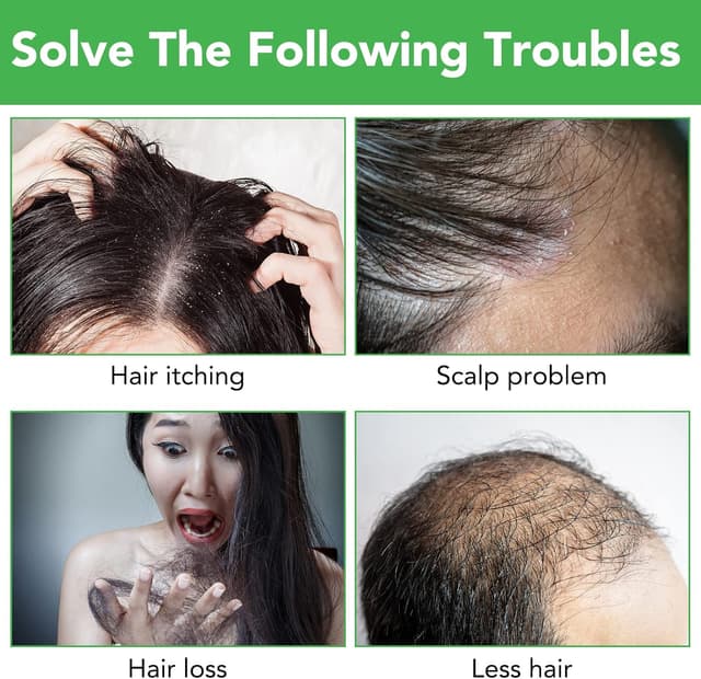 Detalle de Olio Essenziale di Rosmarino e Shampoo al Rosmarino 100% Puro Biologico per la crescita dei capelli