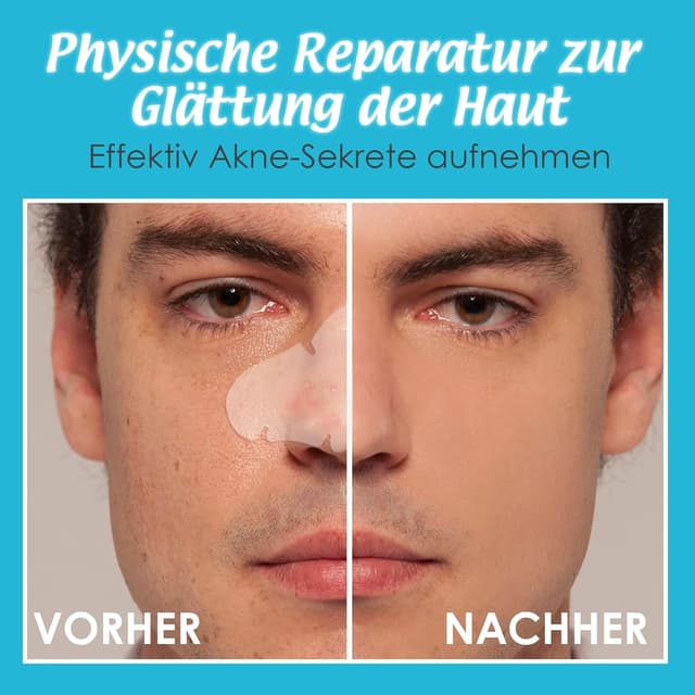 Thumbnail 4 de PimpleGuard Cerotti Brufoli Invisibile 20 pezzi