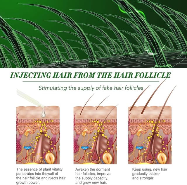 Detalle 1 de Rosmarinöl für Haare 120 ml