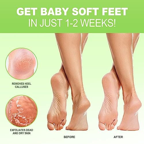 Thumbnail 1 de JVR Fußmaske Milchsäure-Peeling 3er Set