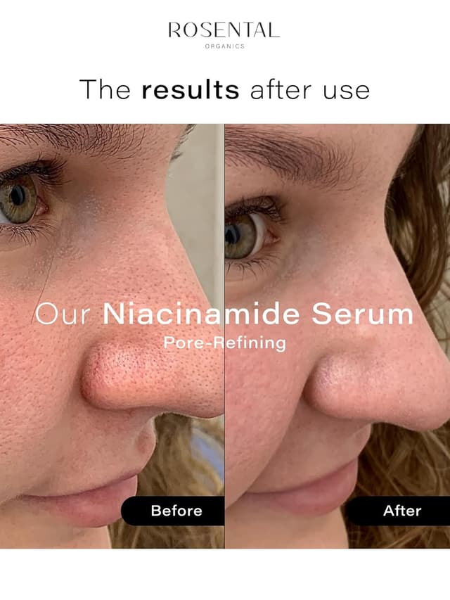 Detalle de Rosental Organics Niacinamide+ Serum Pore-Refining Treatment mit 5% Niacinamid und Azelainsäure