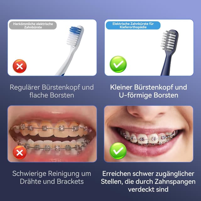 Detalle 2 de JTF Brosse à dents sonique recharge 31 000