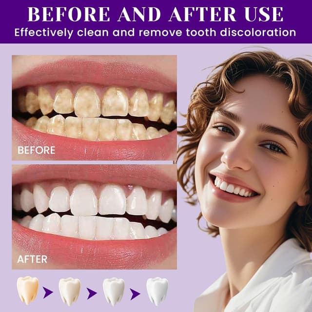 Thumbnail 4 de Pastadientes Púrpura 30 ml blanqueante