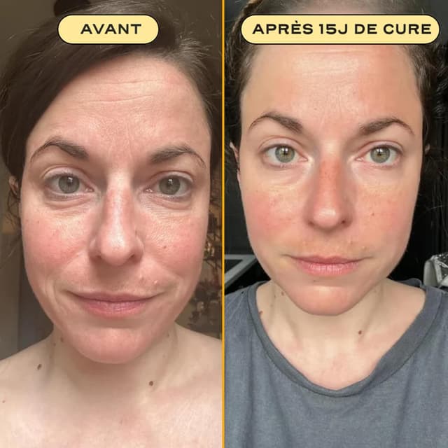 Detalle de Collagen ESSENTIAL Circles, sticks