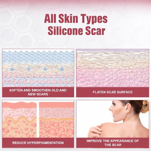 Detalle 1 de ICONRY Silicone scar tape roll 1.6 in