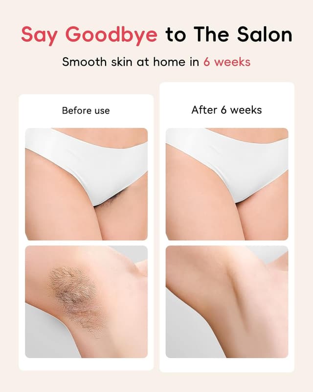 Thumbnail 1 de Haarlosy IPL hair removal device 5.2 cm² window