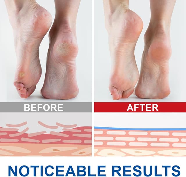 Detalle 2 de Crema urea 60% per piedi e ginocchia