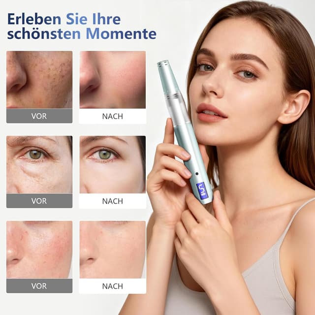 Thumbnail 5 de Rouclo Microneedling Pen mit LCD Display