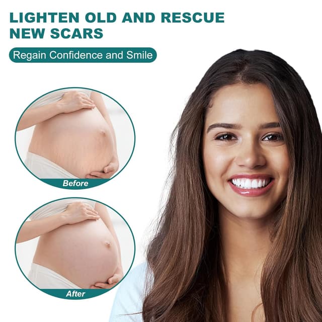 Detalle 2 de Silicone Scar Sheets 1.6" x 158" Roll