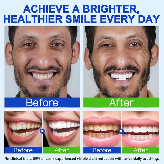 Thumbnail 4 de Feeliville Dentifricio all'idrossiapatite 120 g 🦷