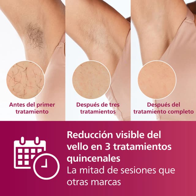 Thumbnail 2 de Philips Lumea Serie 7000 – 12 meses de piel suave