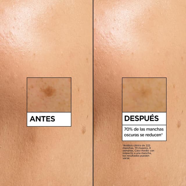 Thumbnail 3 de Garnier SkinActive Vitamina C Sérum Antimanchas Día