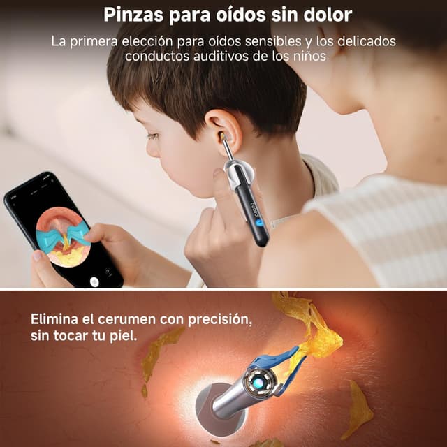 Thumbnail 3 de Bebird R1 Ultra limpiador de oídos con cámara