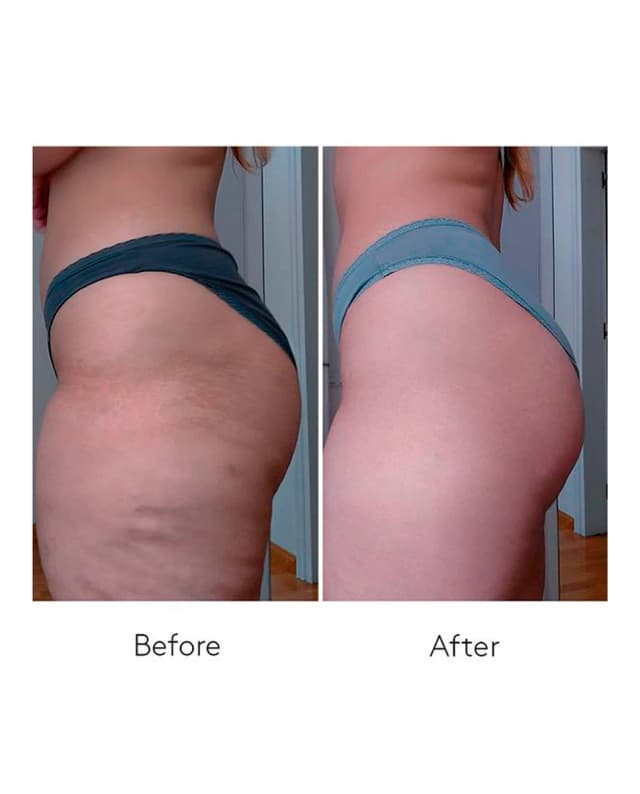 Thumbnail 4 de Cocunat Dúo Anticelulítico Body Power — 2 unidades