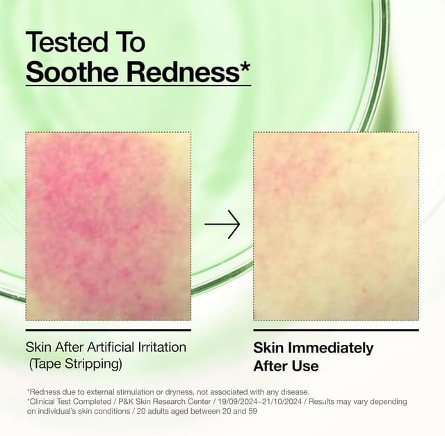 Thumbnail 4 de Anua Azelaic 10 Hyaluron Serum