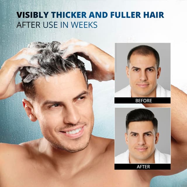 Detalle de Root Activator Shampoo for Men (Made in USA) — Herbal Hair Growth Shampoo for Thinning Hair