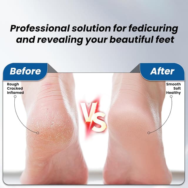 Thumbnail 4 de PKBD Electric Foot File rechargeable foot file 🦶