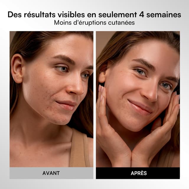 Thumbnail 4 de INIA Masque LED 220 perles 💆