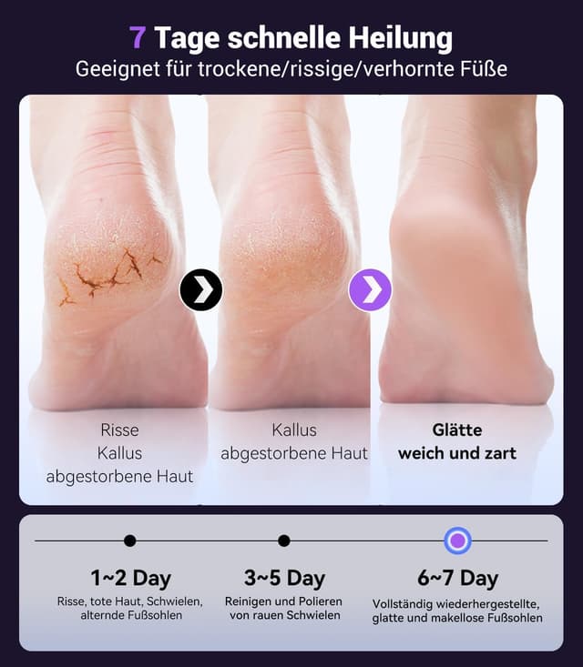 Thumbnail 6 de Elektrischer Hornhautentferner mit 9 Geschwindigkeiten (Type-C, violett) – für glatte Fersen & weniger rissige Haut