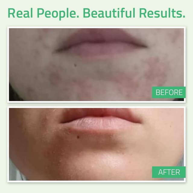 Detalle 2 de YEOUTH Acide Glycolique Peeling Visage 30% au rétinol et thé vert – exfoliant chimique à domicile (60 ml)