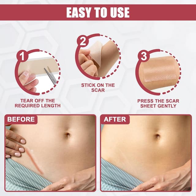 Detalle 2 de ICONRY Silicone scar tape roll 1.6 in