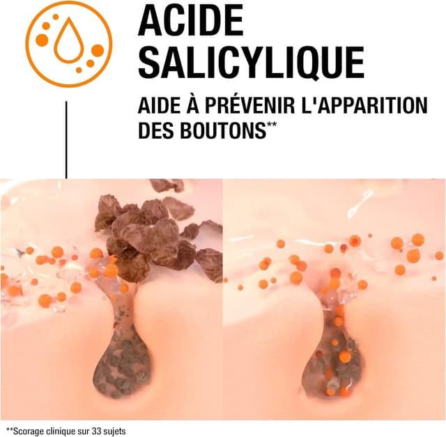 Thumbnail 6 de Neutrogena Trattamento idratante anti-brufoli 50 ml