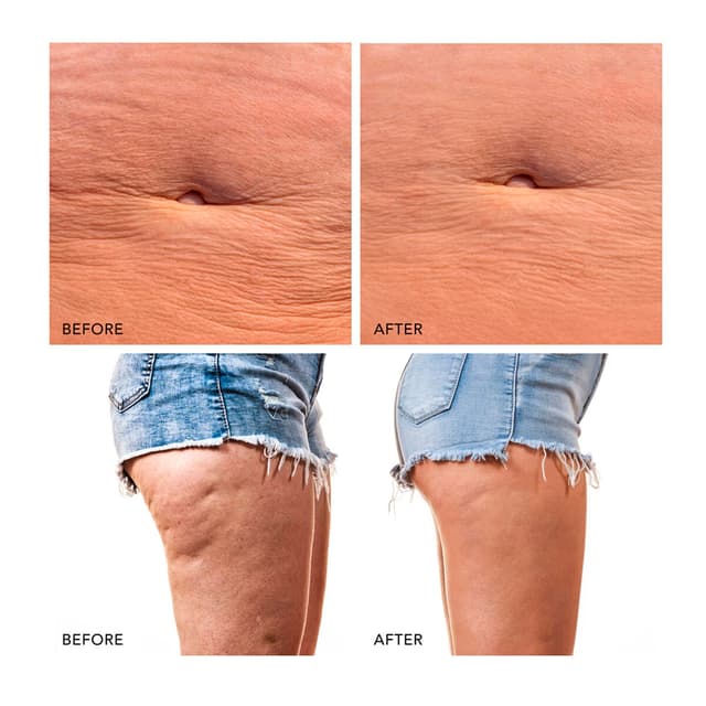 Thumbnail 3 de FOREO BEAR™ 2 body Dispositivo corporal de microcorrientes Evergreen