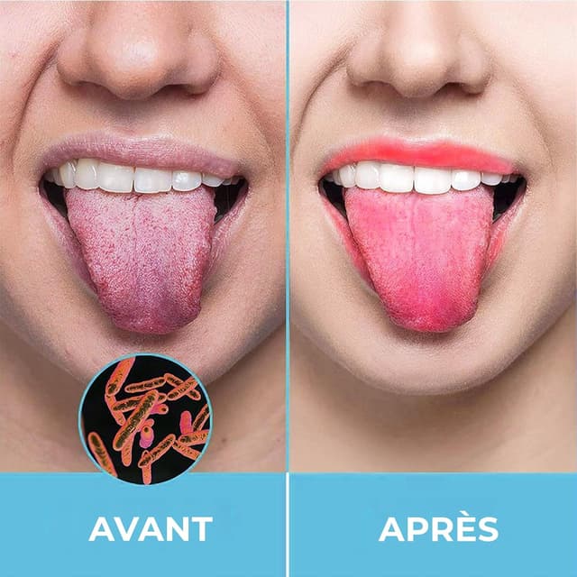 Detalle de HOKIN gratte-langue adulte en acier inoxydable pour mauvaise haleine (1 pièce)