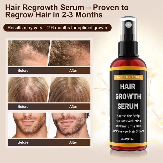 Thumbnail 1 de Spray siero crescita capelli