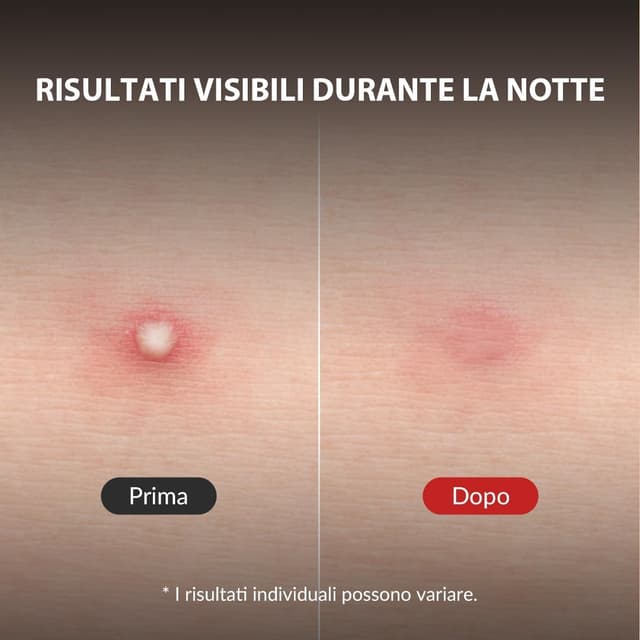 Thumbnail 3 de Mizon Good Bye Blemish Clear Patch 44 pezzi