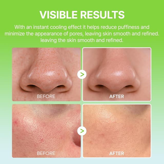 Thumbnail 5 de Dr.Melaxin Cactox Pore Relief Balm Stick