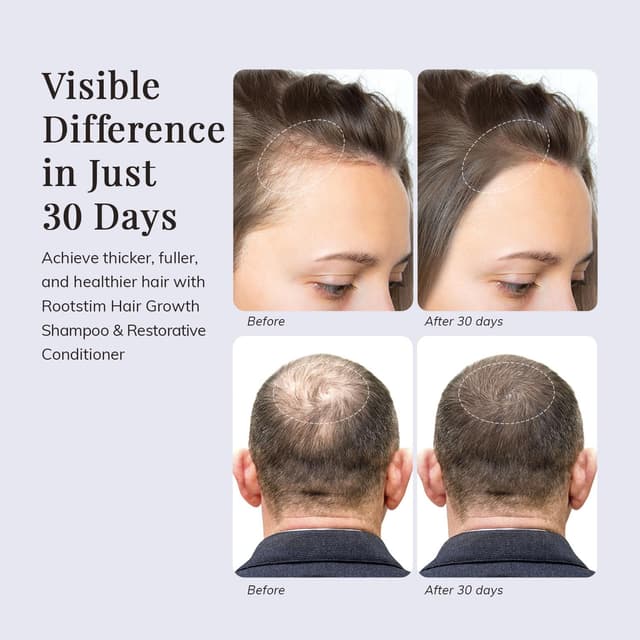 Detalle 2 de RootStim Hair Growth Shampoo Set 2-Pack