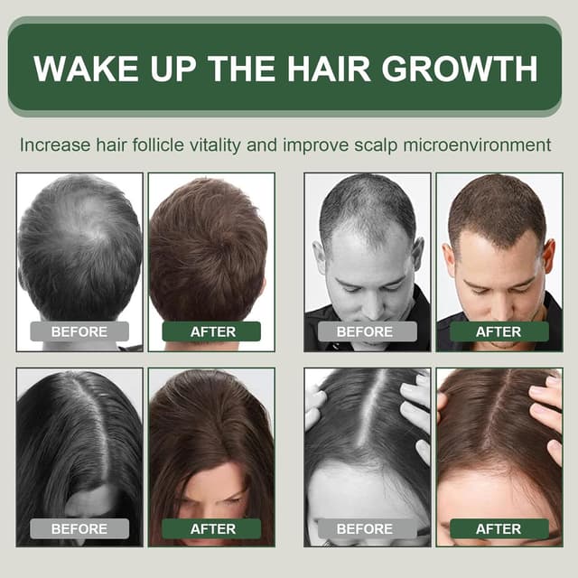 Thumbnail 3 de Olio capelli 60ml Crescita Capelli Rosmarino 💇♀