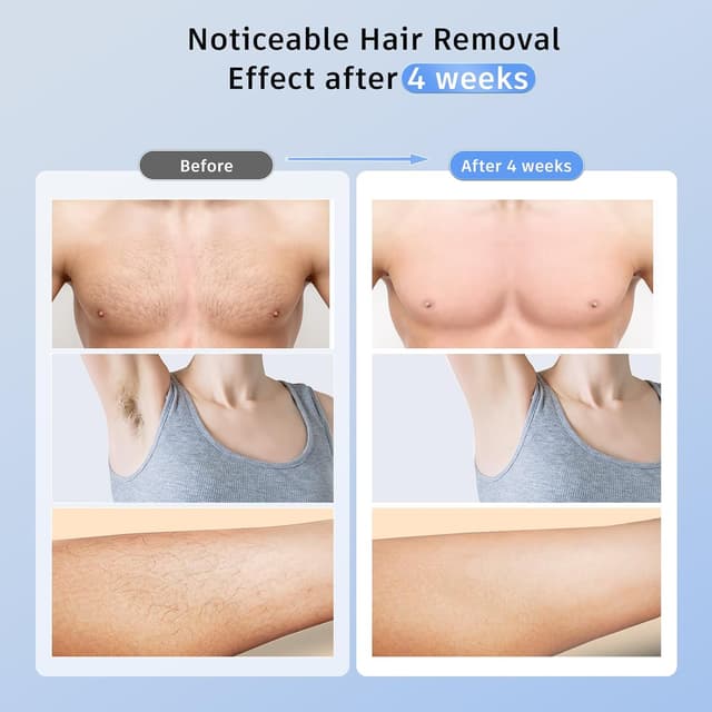 Thumbnail 6 de Ubroo IPL Hair Removal Device 3-in-1 🪒