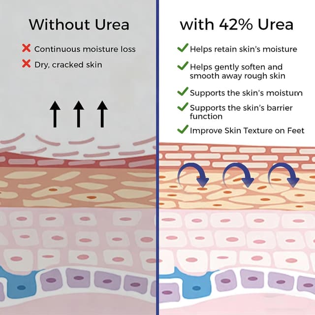 Thumbnail 4 de OUKEYA Urea-Creme 42% plus Salicylsäure 2% – Harnstoffcreme